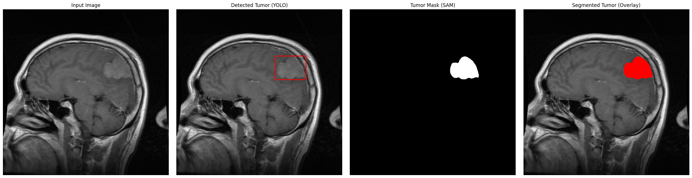 Brain Tumor Detection